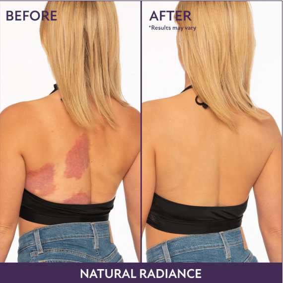 Luminova™ Body Perfector+