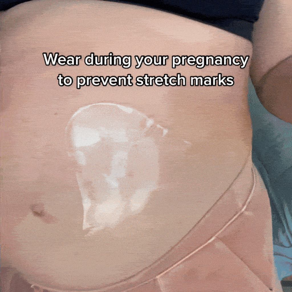 Silicone StretchMark Pack™